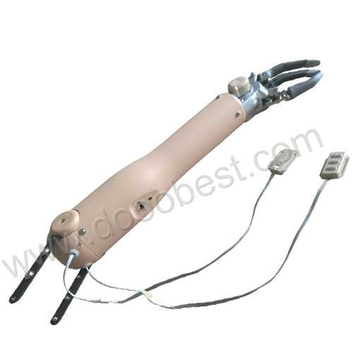 Two degree of freedom myo  electric hand for  elbow disarticulation